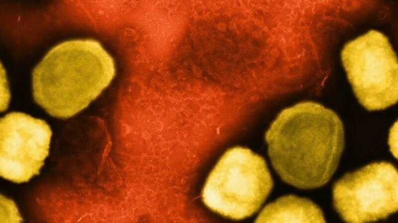 OMS alerta sobre nova variante de mpox e pede urgência