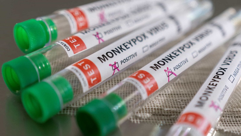 É questão de tempo, diz médico sobre disseminação de Mpox pelo mundo – Jornal Advogado – Em Mato Grosso