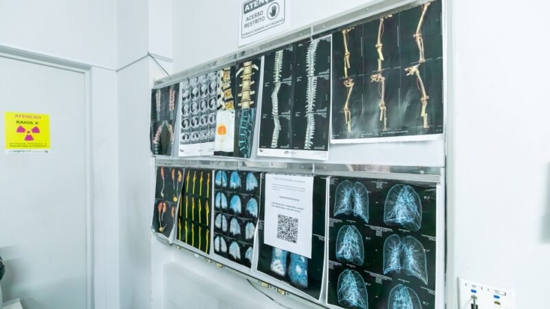 Cuiabá instala ressonância magnética de última geração no São Benedito